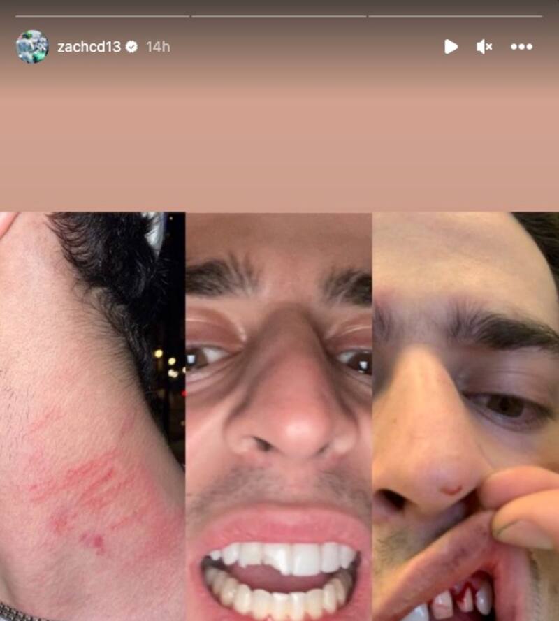 Un joueur de la LNH accusÃ© dâavoir agressÃ© un pilote de course quÃ©bÃ©cois – TVA Sports